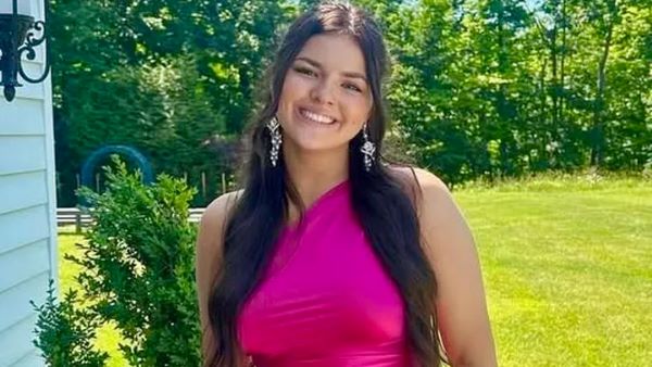 GoFundMe page set up for Binghamton burn victim